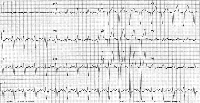 Read more about the article ECG Case 251