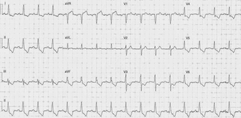 Read more about the article ECG Case 252