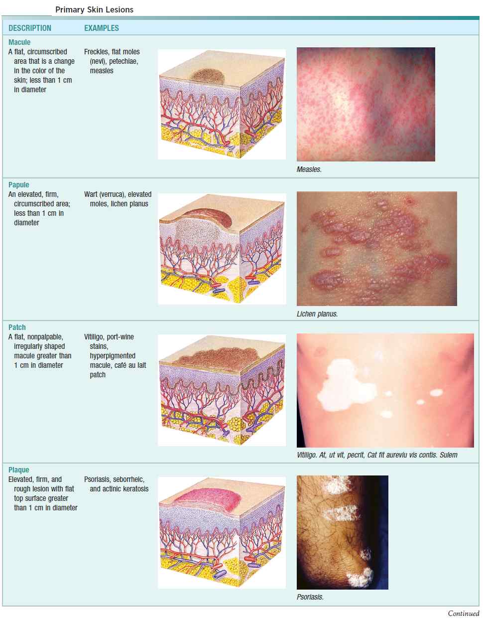 Primary Skin Lesions (Macule, Papule, Patch, Plaque)