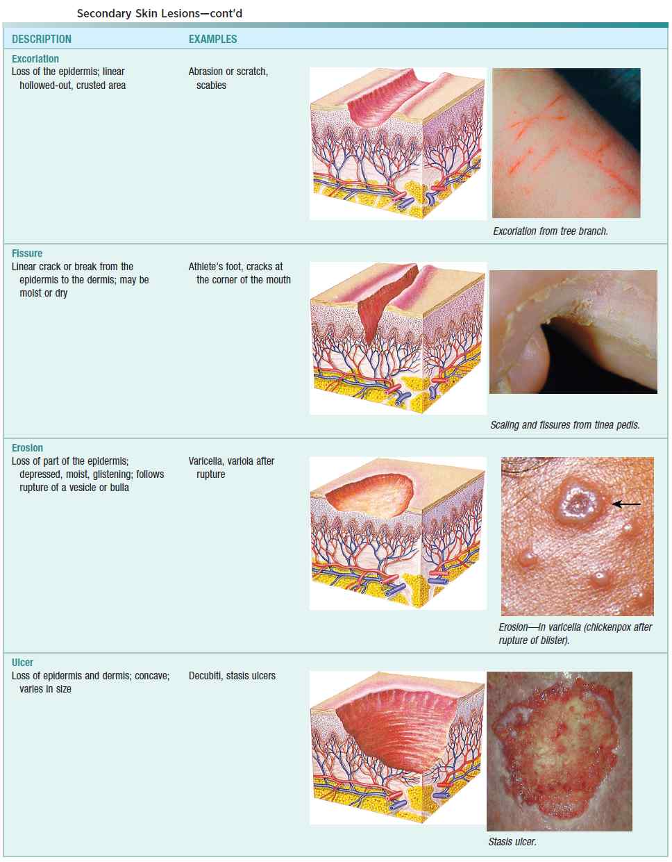 Skin Rashes Evaluation And Diagnosis Manual Of Medicine