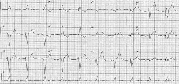 Read more about the article ECG Case 255