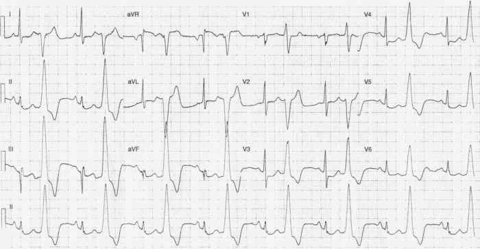 Read more about the article ECG Case 256