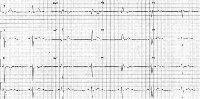 Read more about the article ECG Case 257