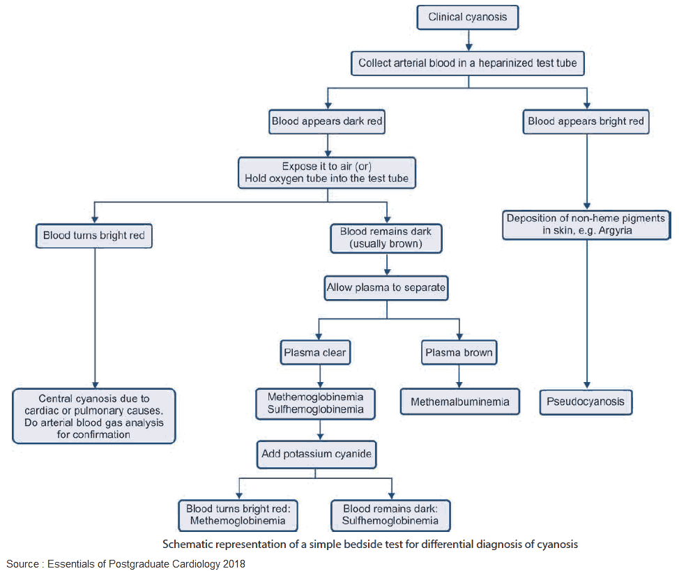 Schematic Representation of a Simple Bedside Test for Differential Diagnosis of Cyanosis