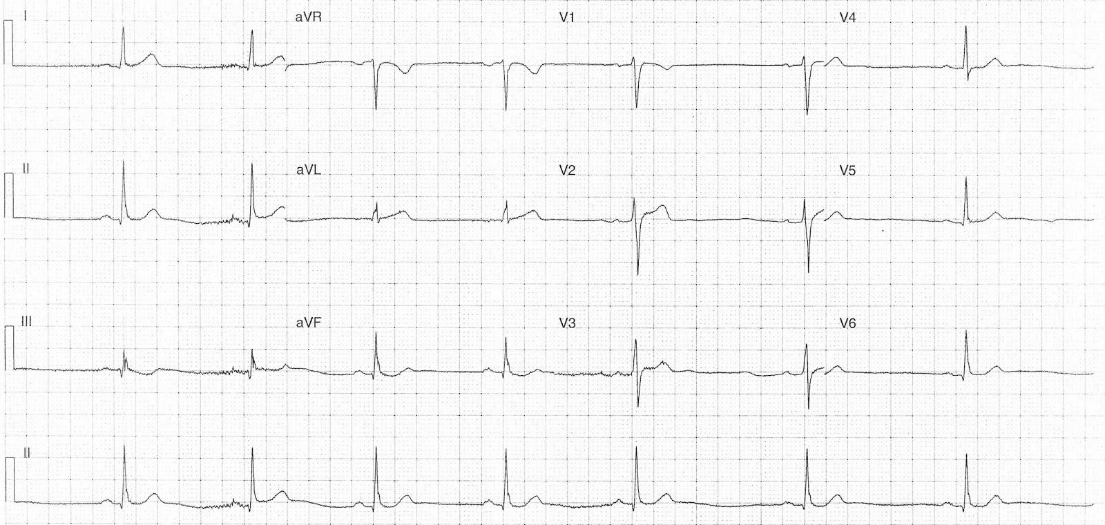 Read more about the article ECG Case 260