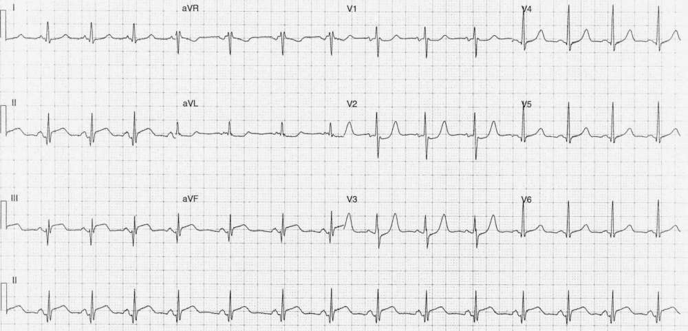 Read more about the article ECG Case 258