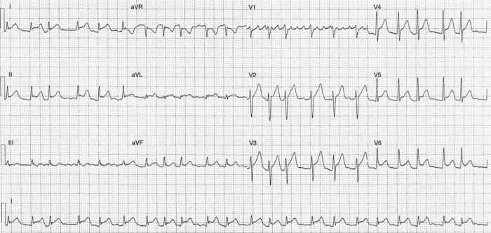 Read more about the article ECG Case 259