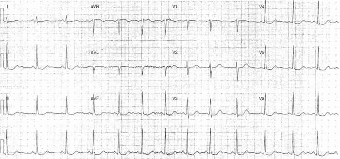 Read more about the article ECG Case 270