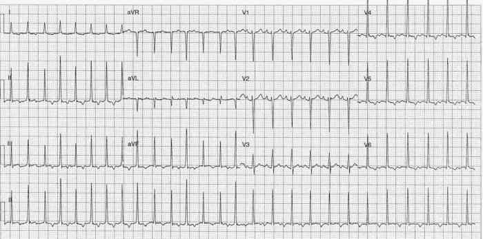 Read more about the article ECG Case 272