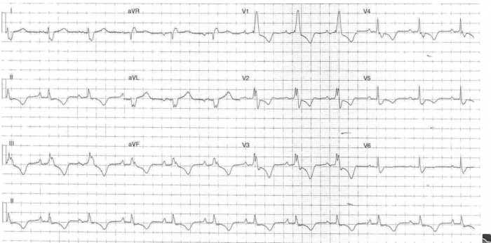 Read more about the article ECG Case 273