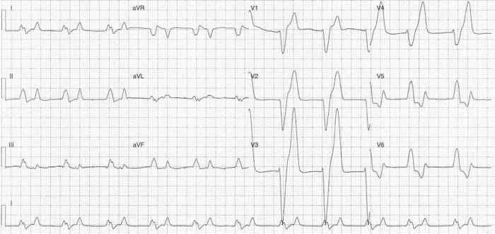 Read more about the article ECG Case 275