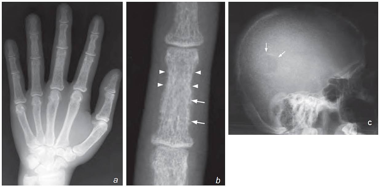 Read more about the article Patient with Lethargy, Polydipsia and Polyuria