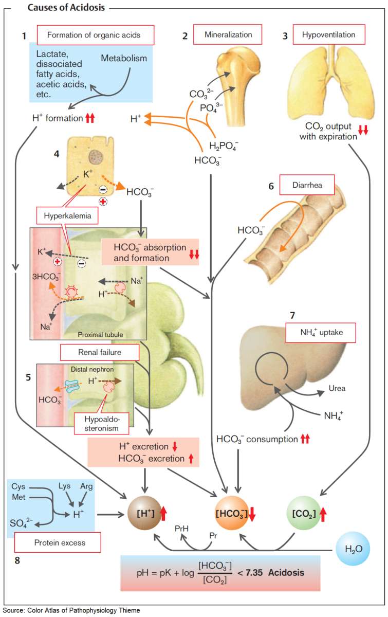 Causes of Acidosis