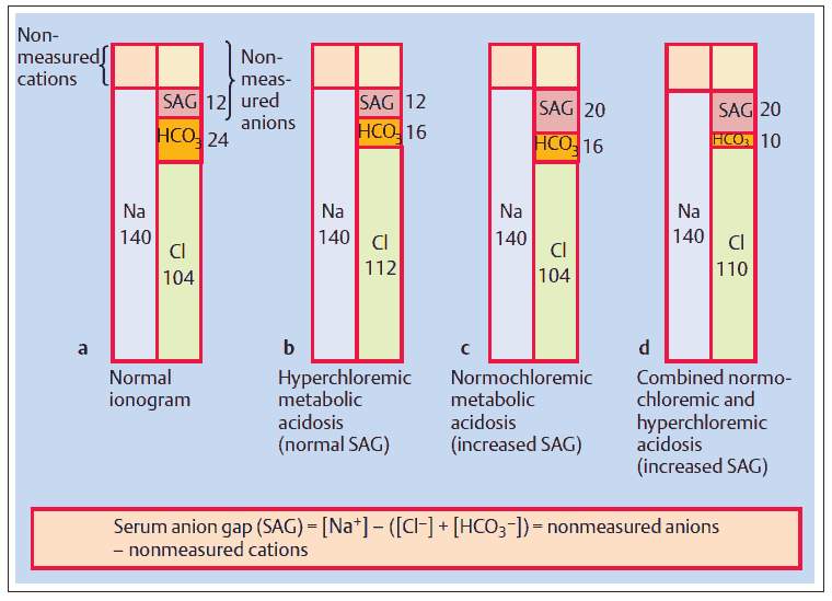 Definition of the serum anion gap (SAG) shown with ionograms