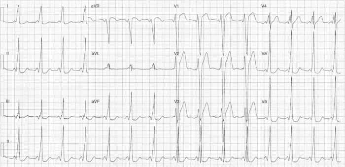 Read more about the article ECG Case 277