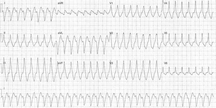 Read more about the article ECG Case 279