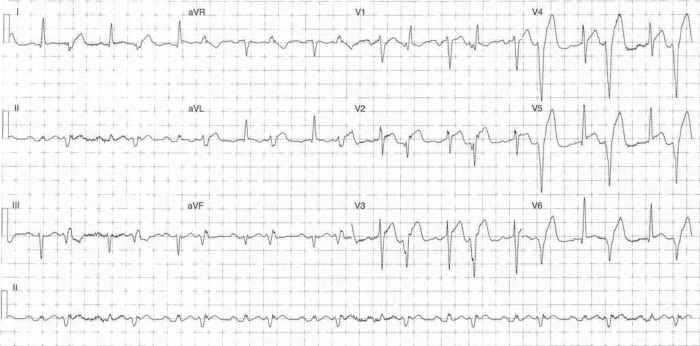 Read more about the article ECG Case 280