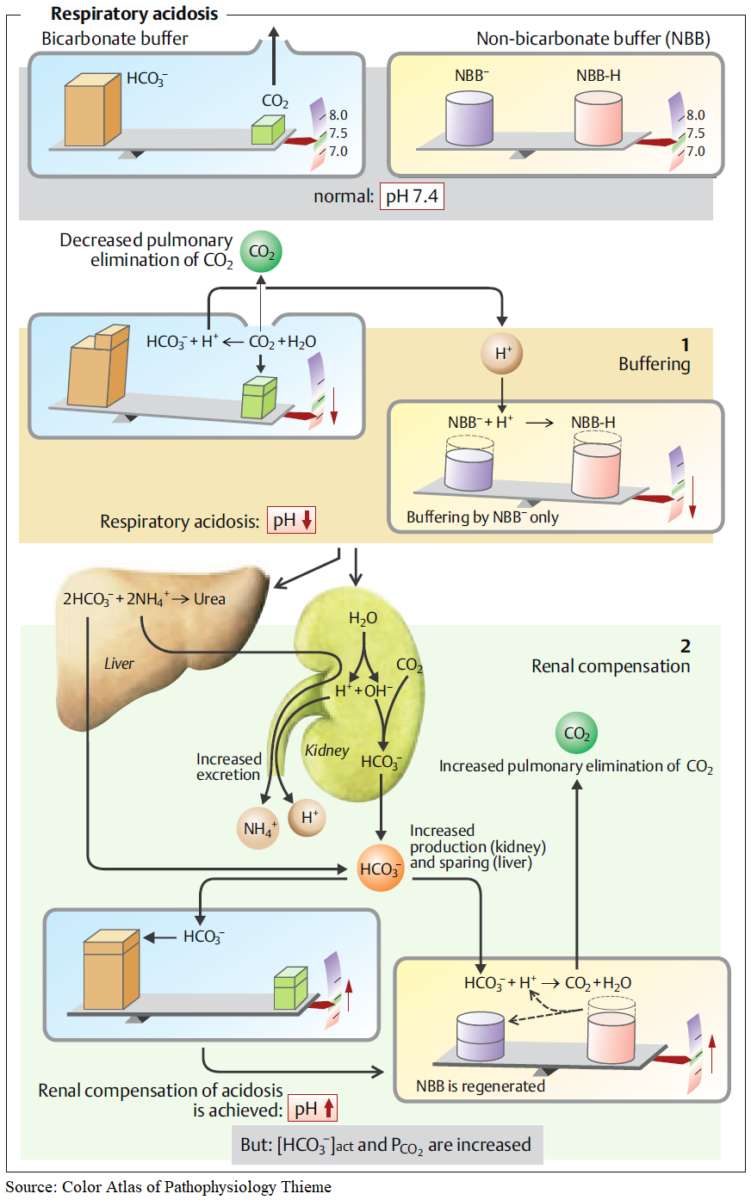 Respiratory Acidosis - Pathophysiology