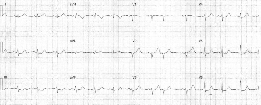 Read more about the article ECG Case 281