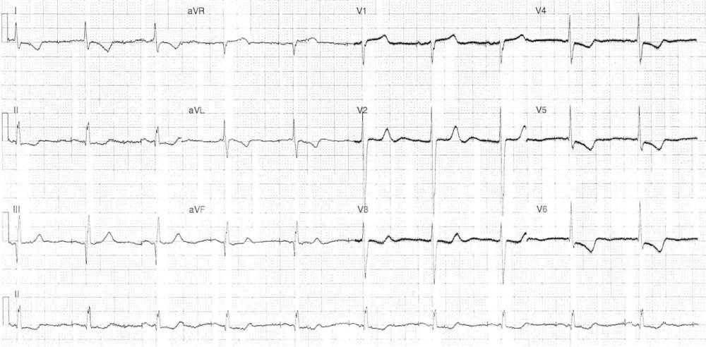 Read more about the article ECG Case 282