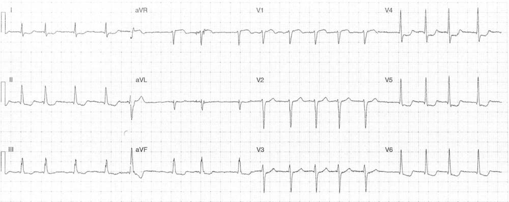 Read more about the article ECG Case 283