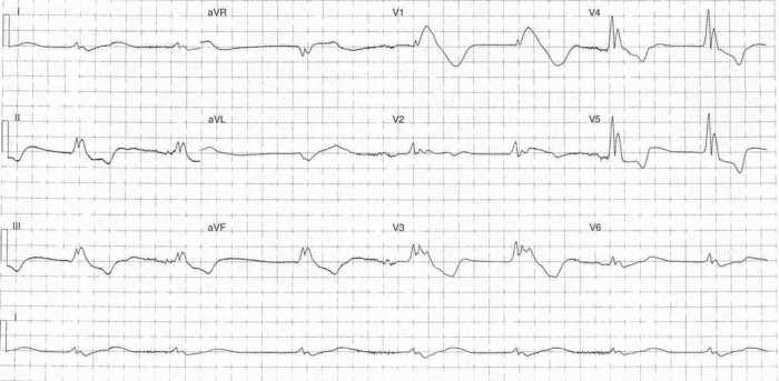 Read more about the article ECG Case 284