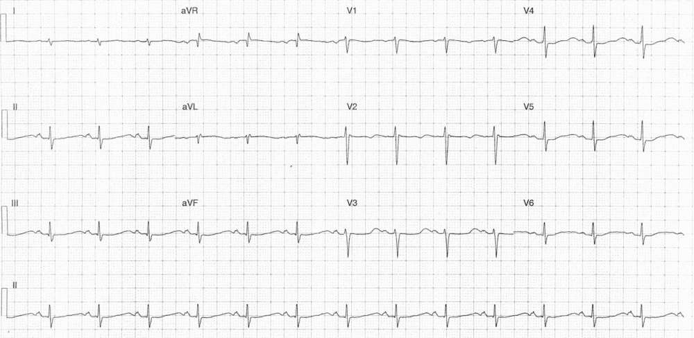 Read more about the article ECG Case 285