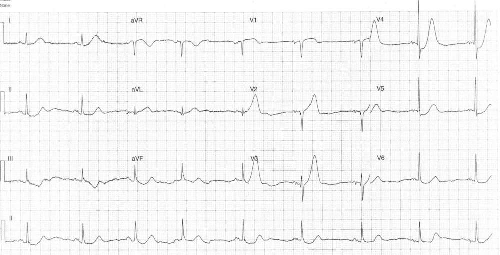 Read more about the article ECG Case 286