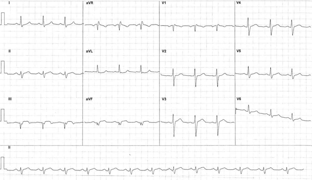Read more about the article ECG Case 287