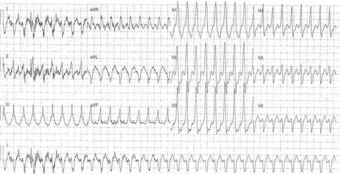 Read more about the article ECG Case 288