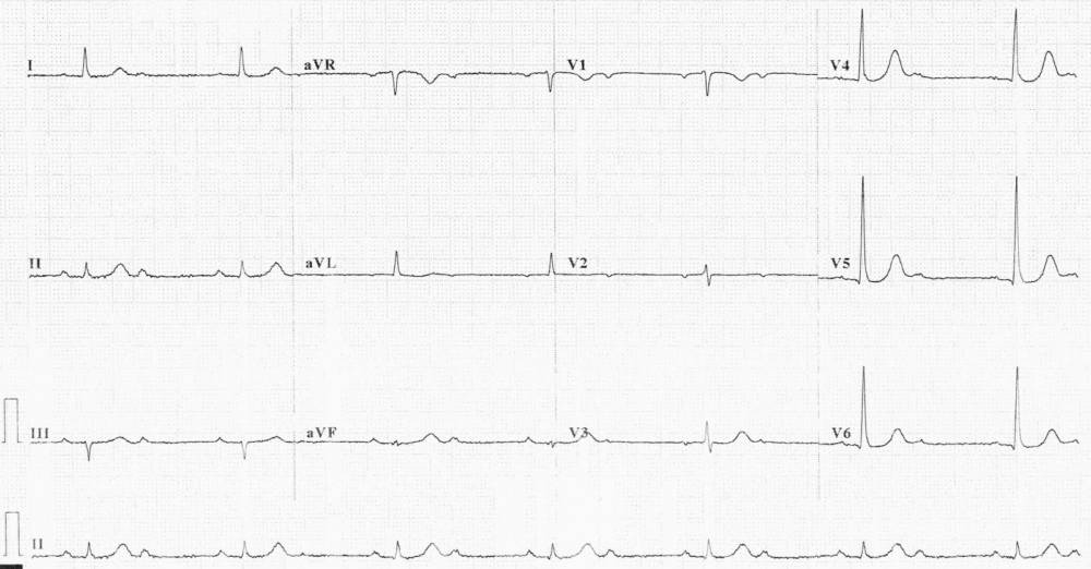 Read more about the article ECG Case 289
