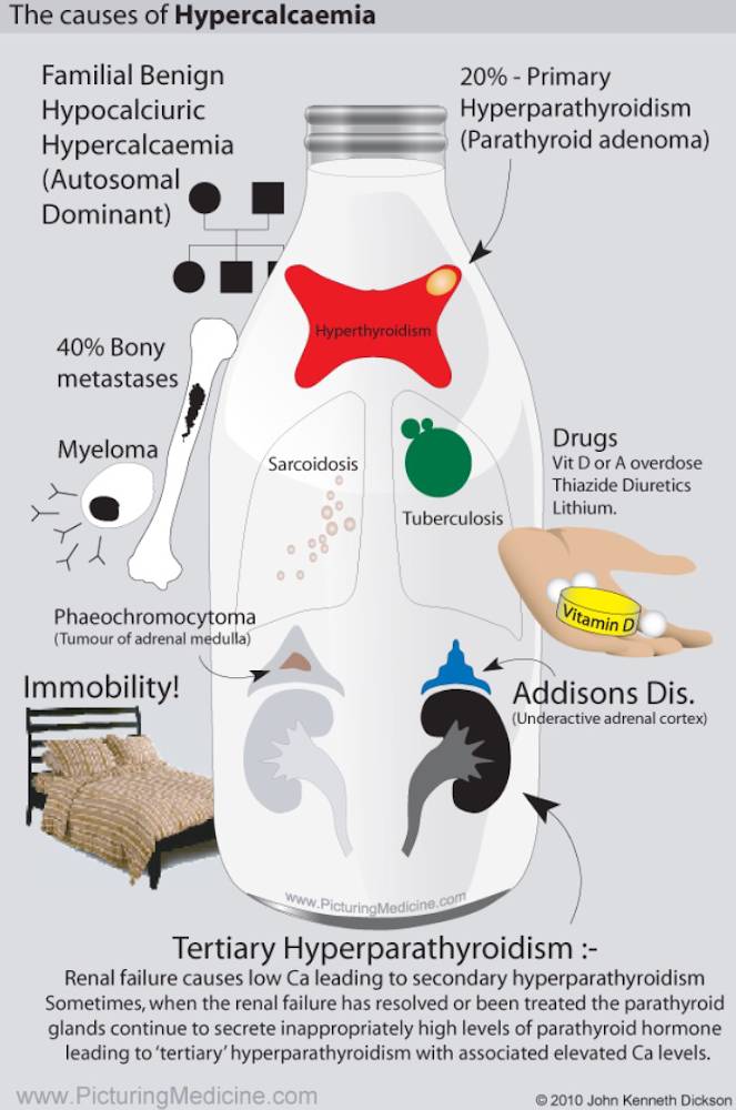 The Causes of Hypercalcemia