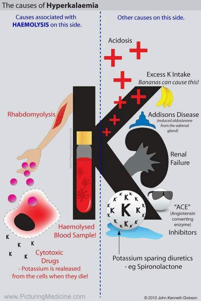 The Causes of Hyperkalemia