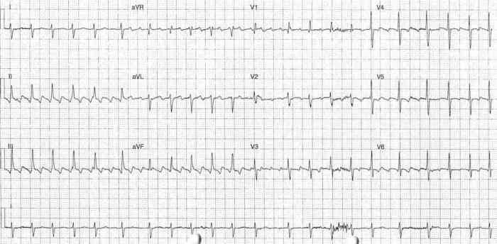 Read more about the article ECG Case 291