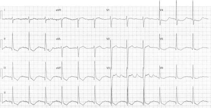 Read more about the article ECG Case 294