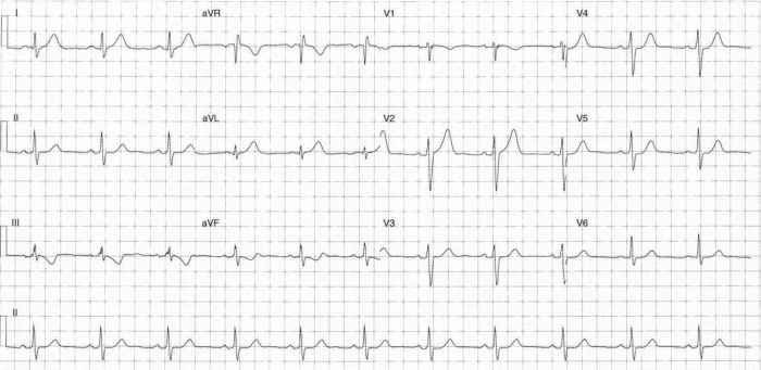 Read more about the article ECG Case 295
