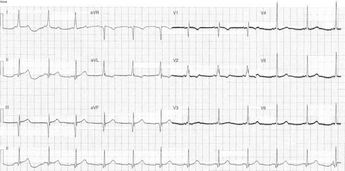 Read more about the article ECG Case 296