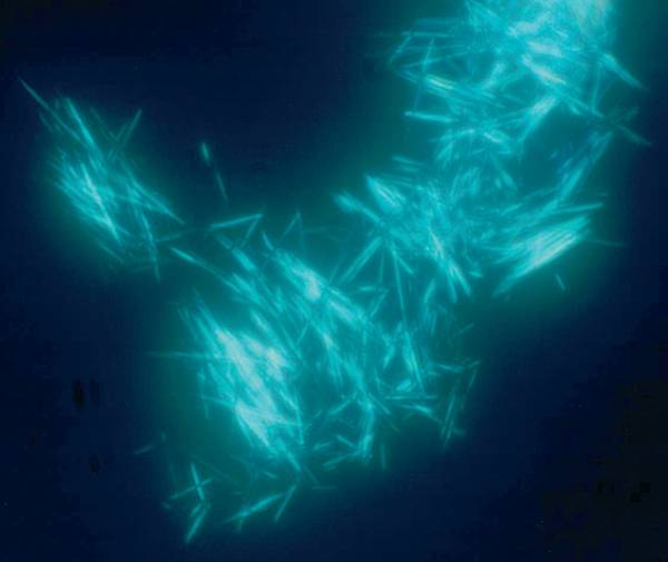 Negatively birefringent urate crystals