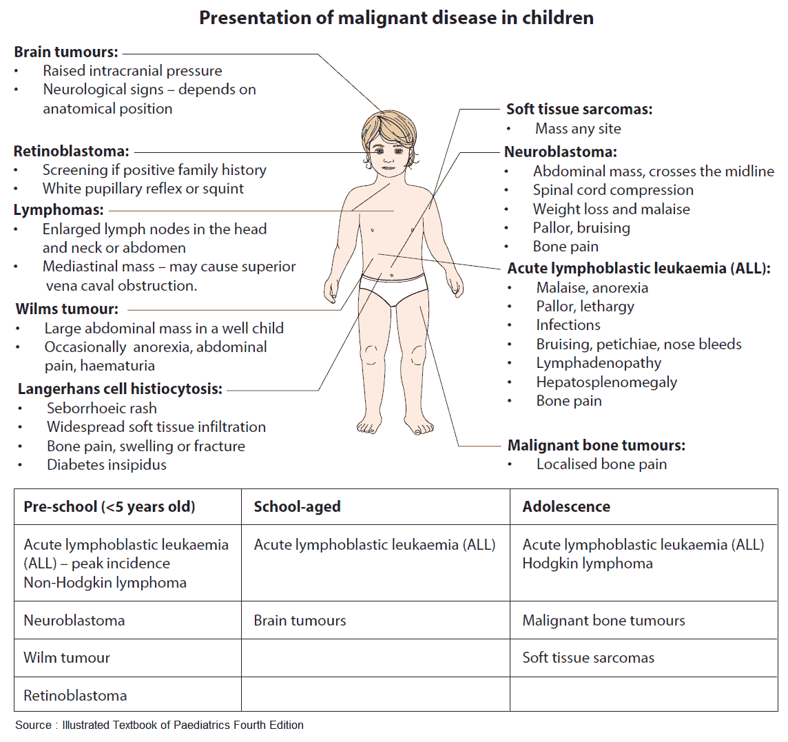 Presentation of malignant disease in children