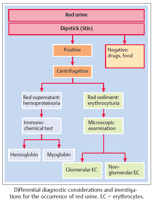 Differential diagnostic considerations and investigations for the occurrence of red urine