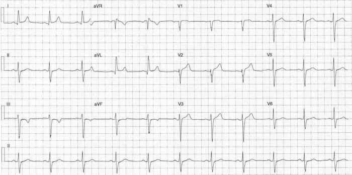 Read more about the article ECG Case 297