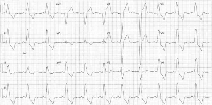 Read more about the article ECG Case 300