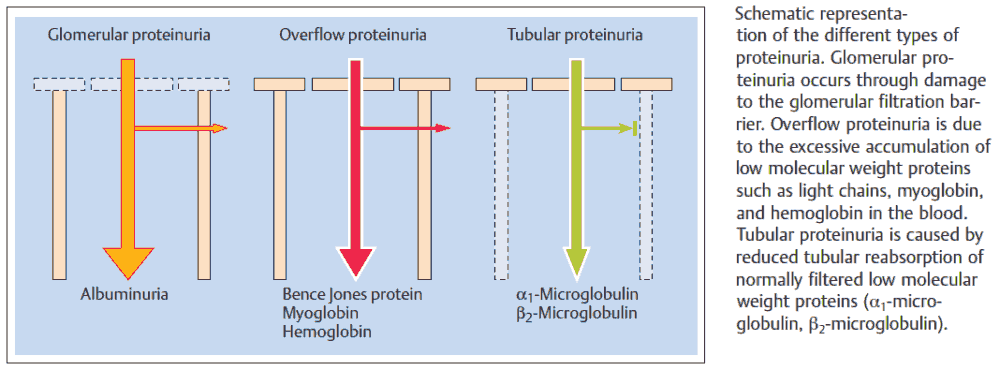 Schematic representation of the different types of proteinuria