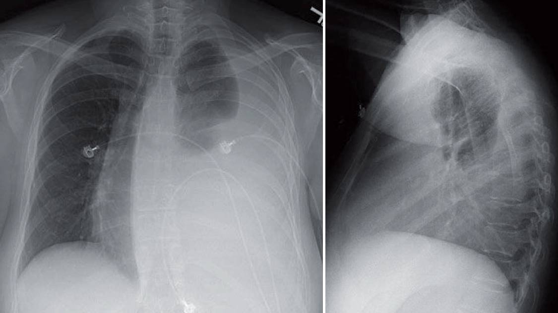 Read more about the article 42-year-old Woman With Shortness of Breath