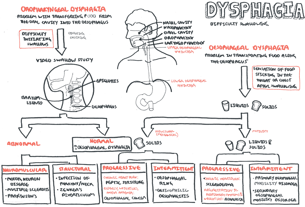 Dysphagia (Difficulty Swallowing) - Differential Diagnosis