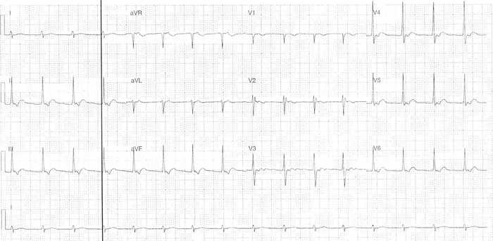 Read more about the article ECG Case 320