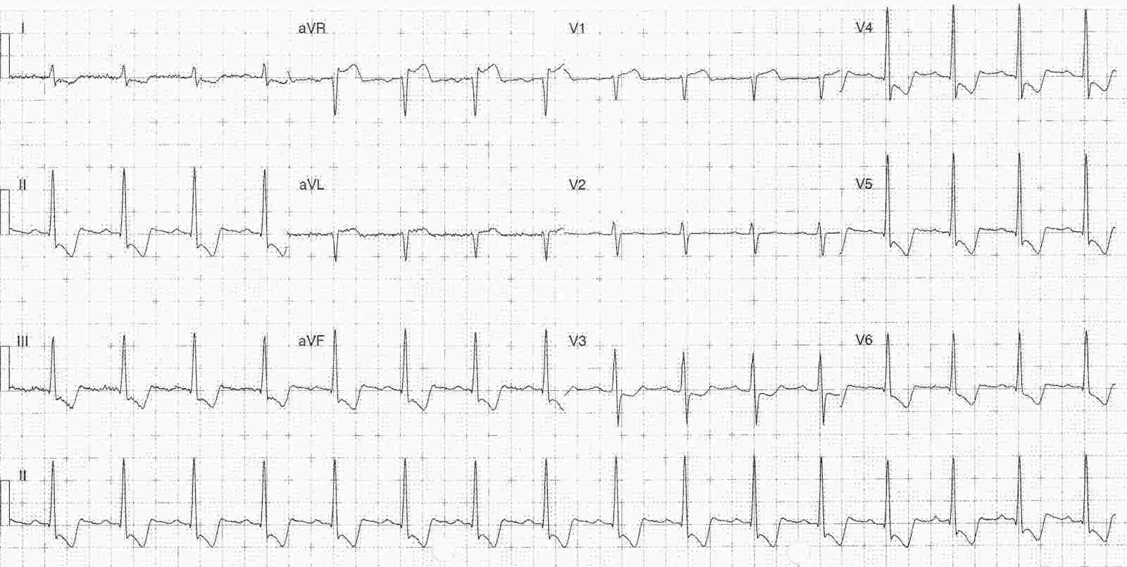 Read more about the article ECG Case 327