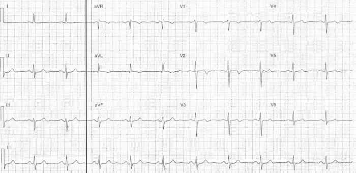 Read more about the article ECG Case 328