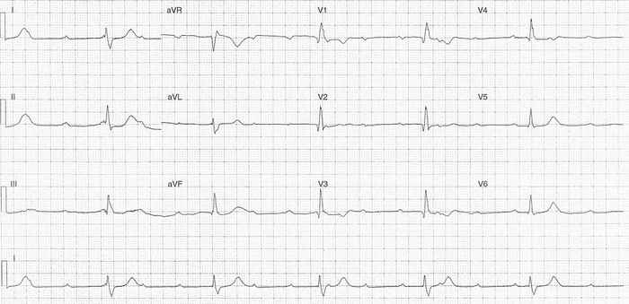 Read more about the article ECG Case 330