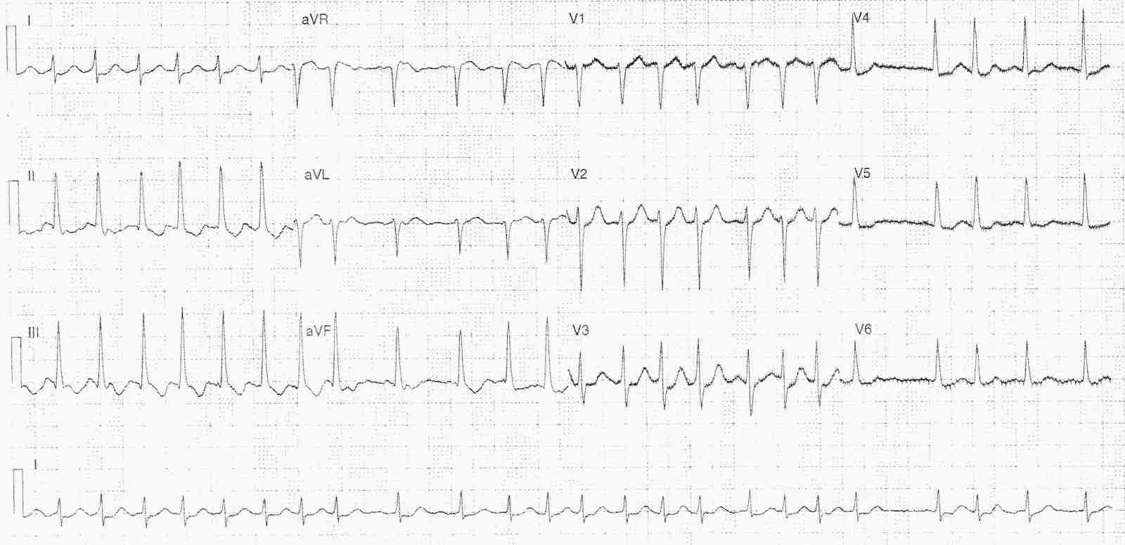 Read more about the article ECG Case 331